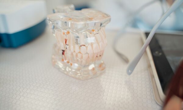 성남 임플란트, 정밀한 디지털 진단으로 완성하는 평생의 자신감
