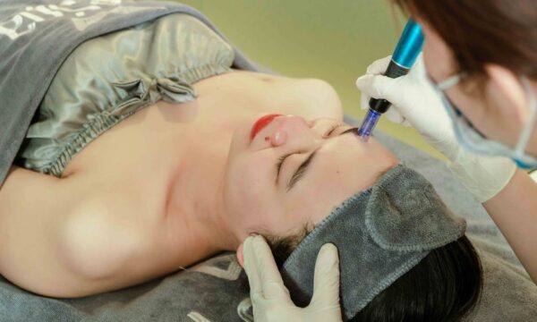 Microdermabrasion – Fast And Easy Acne Scars Treatment in Dubai