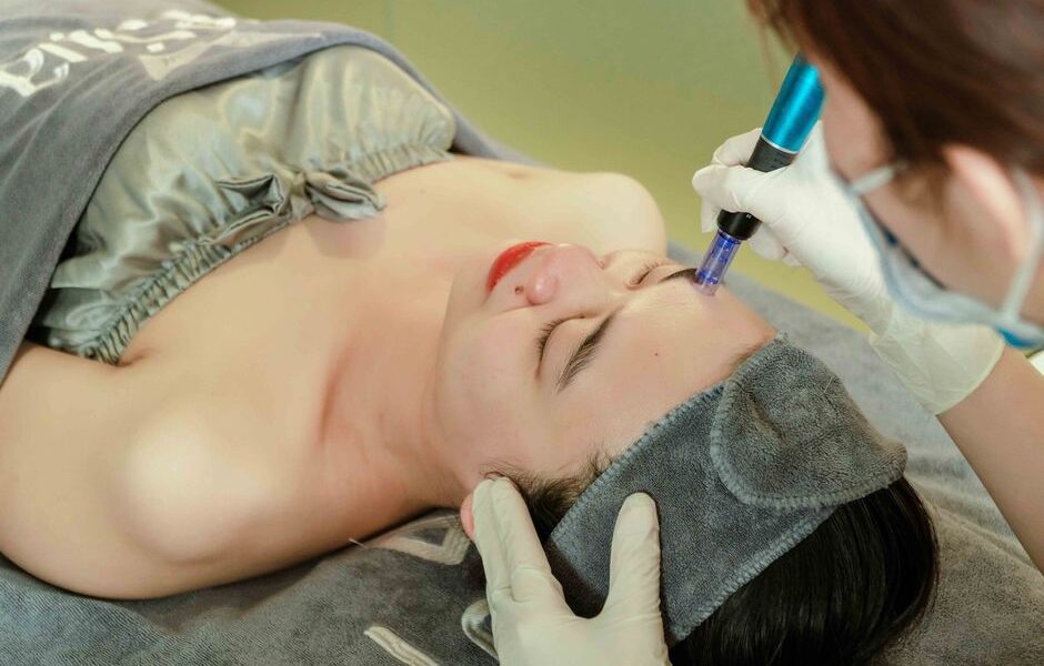 Microdermabrasion – Fast And Easy Acne Scars Treatment in Dubai
